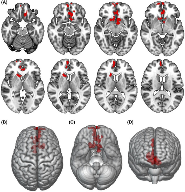 FIGURE 2