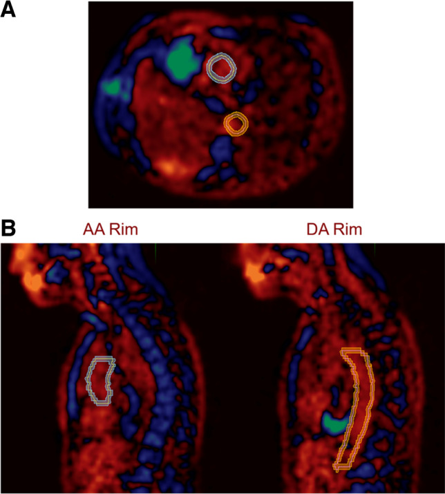 Fig. 2