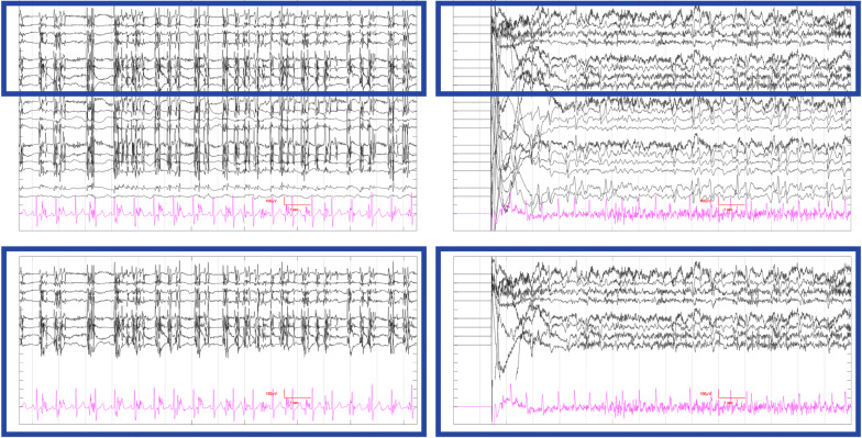 Fig. 4