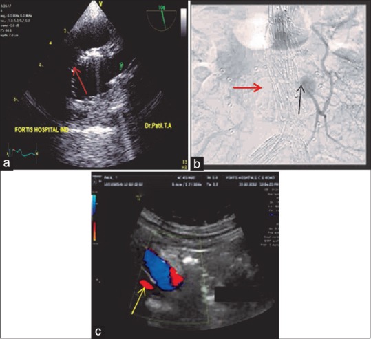 Figure 21