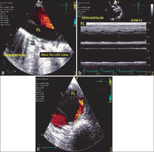 Figure 14