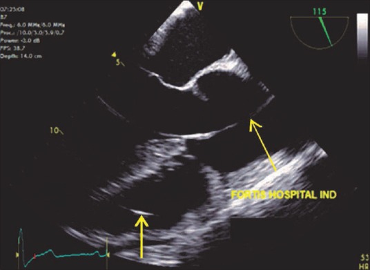 Figure 15