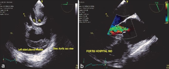 Figure 16