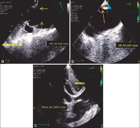 Figure 13