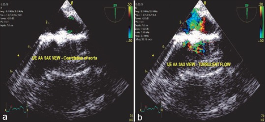 Figure 18