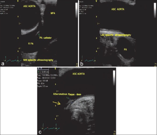 Figure 9