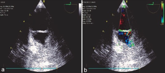 Figure 19