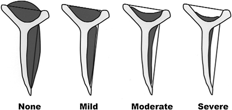 Fig. 3