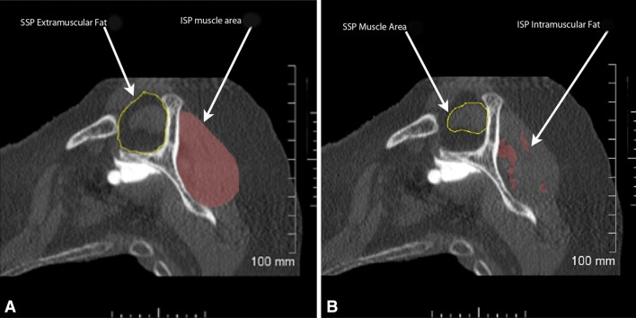 Fig. 2A–B