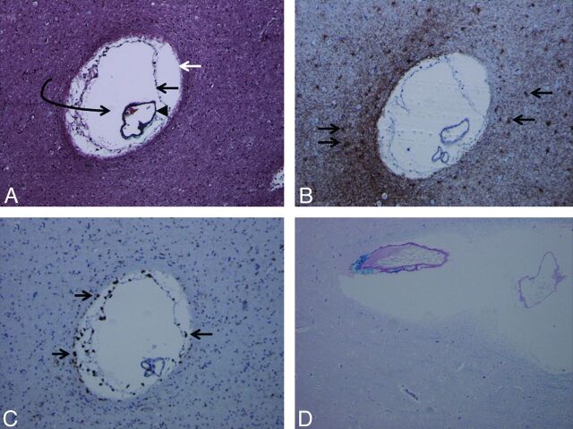 Fig 4.