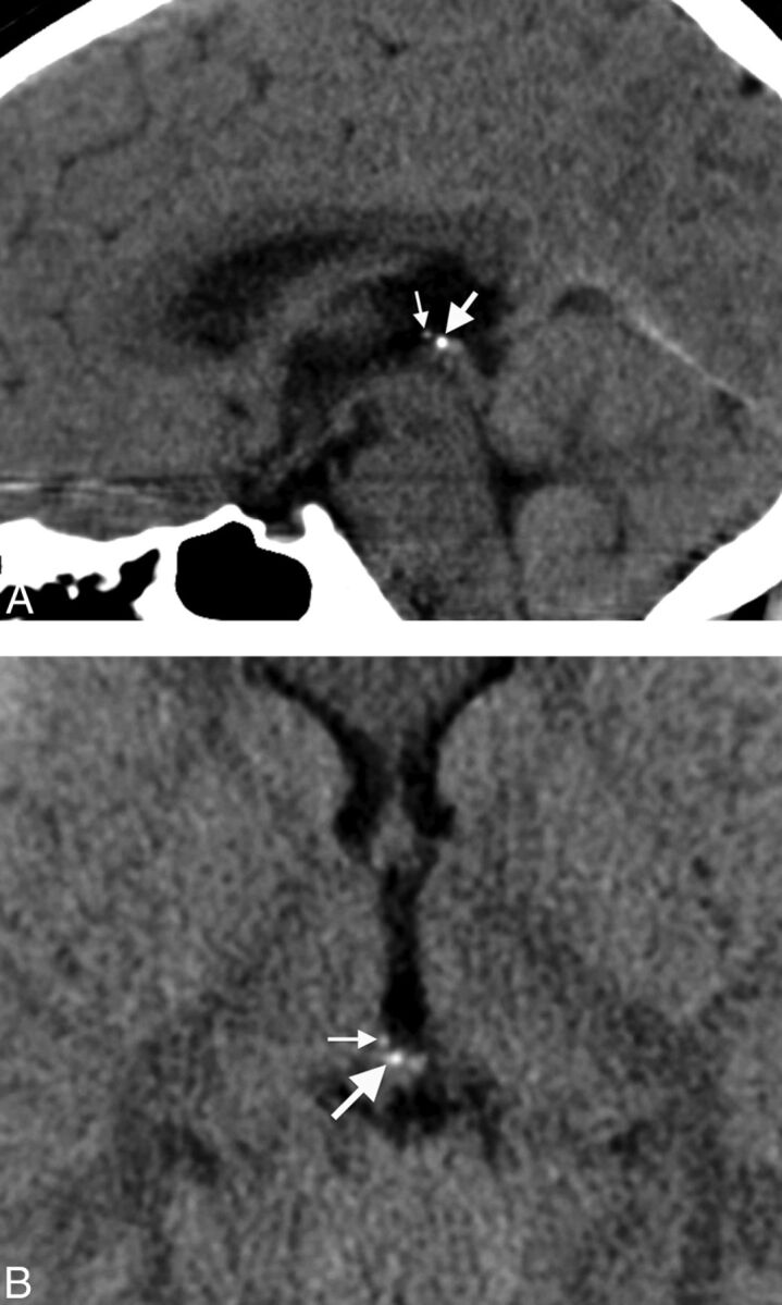 Fig 2.