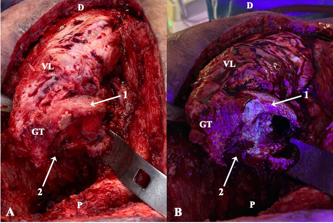 Figure 2