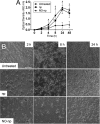 FIG 1