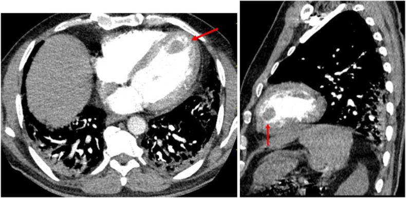 Fig. 9