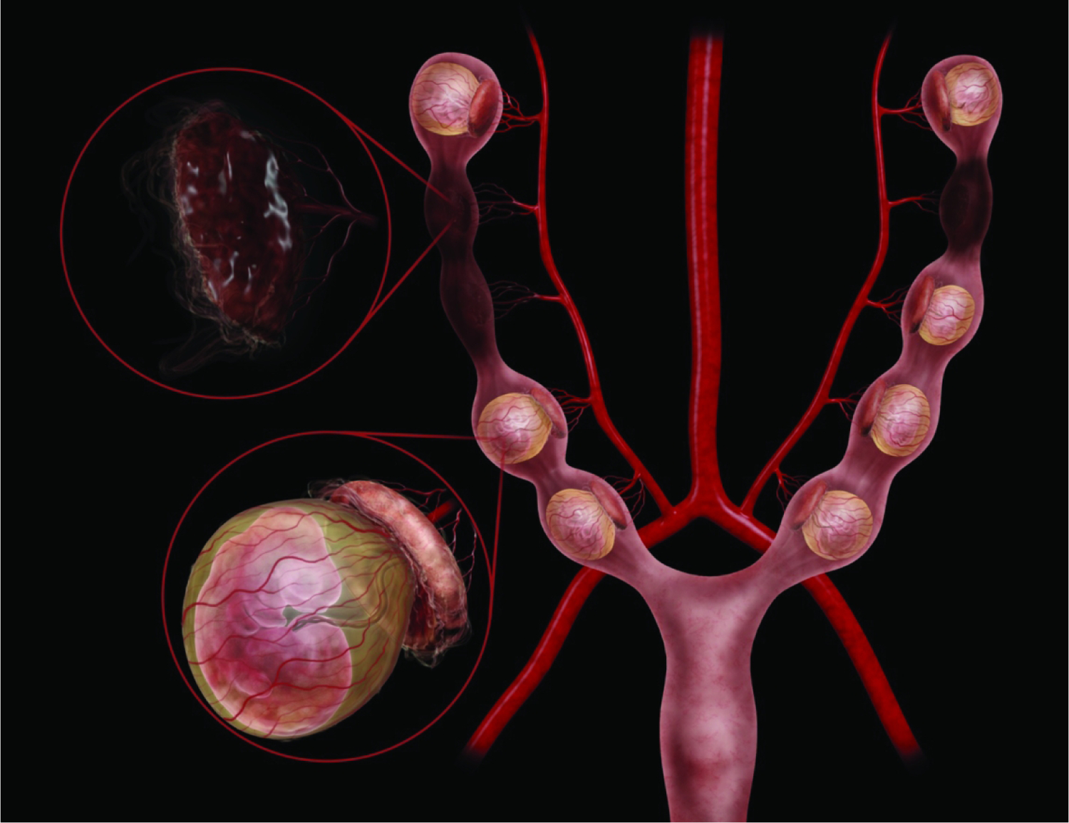 Figure 23.