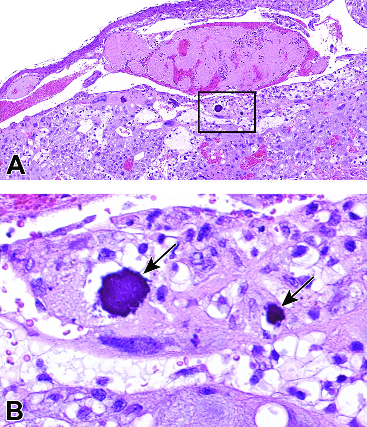 Figure 42.