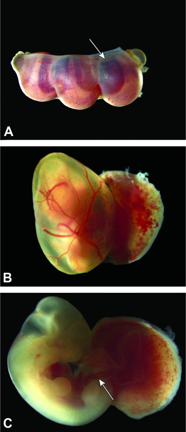 Figure 11.