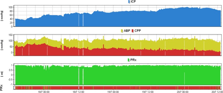 Fig 4