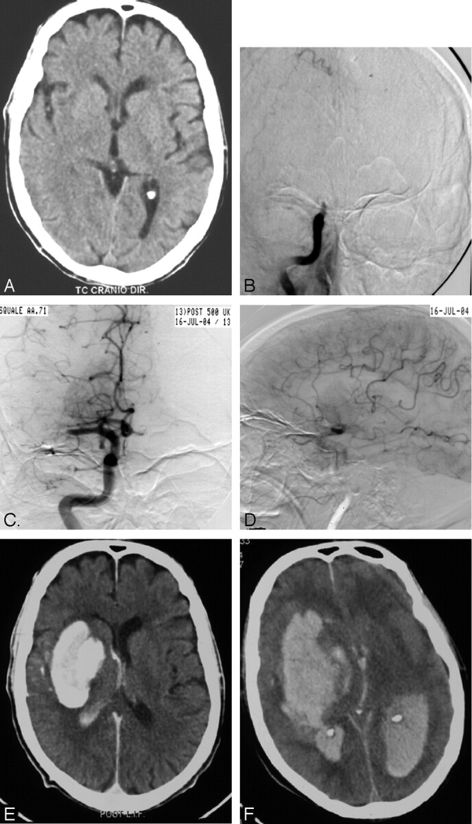 Fig 1.