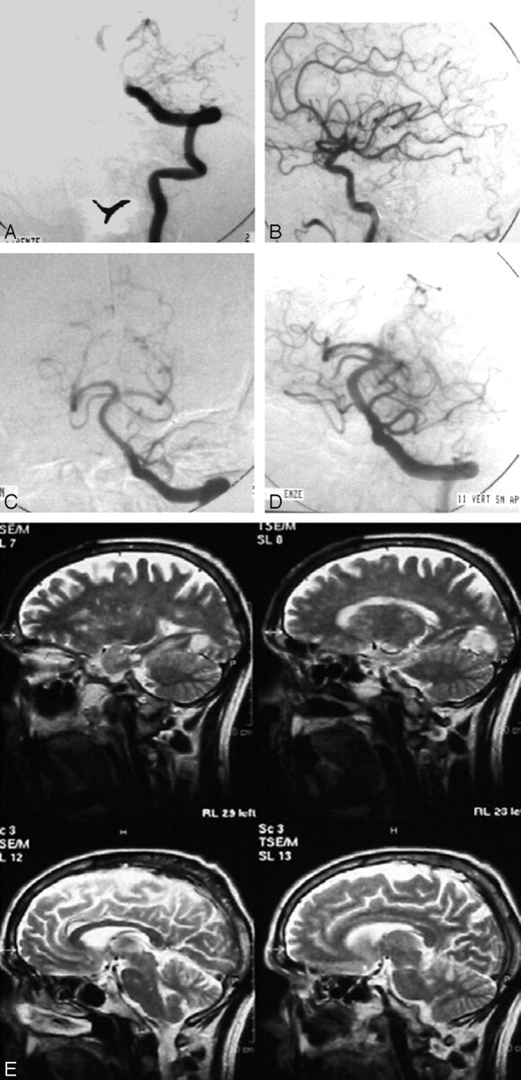 Fig 2.