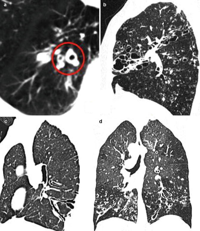 Fig. 16