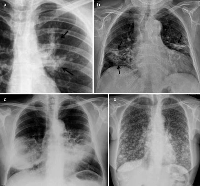 Fig. 14