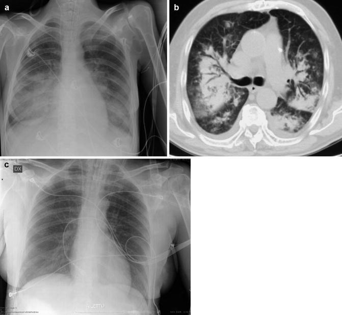 Fig. 4