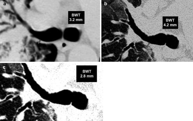 Fig. 22