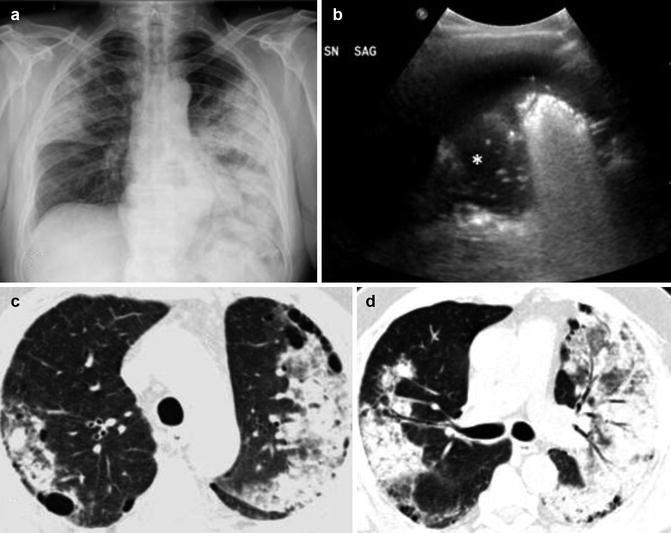 Fig. 19