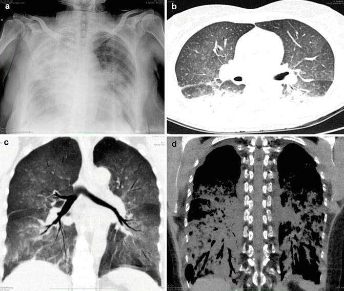 Fig. 10