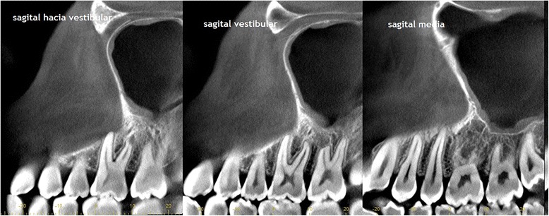 Fig. 9