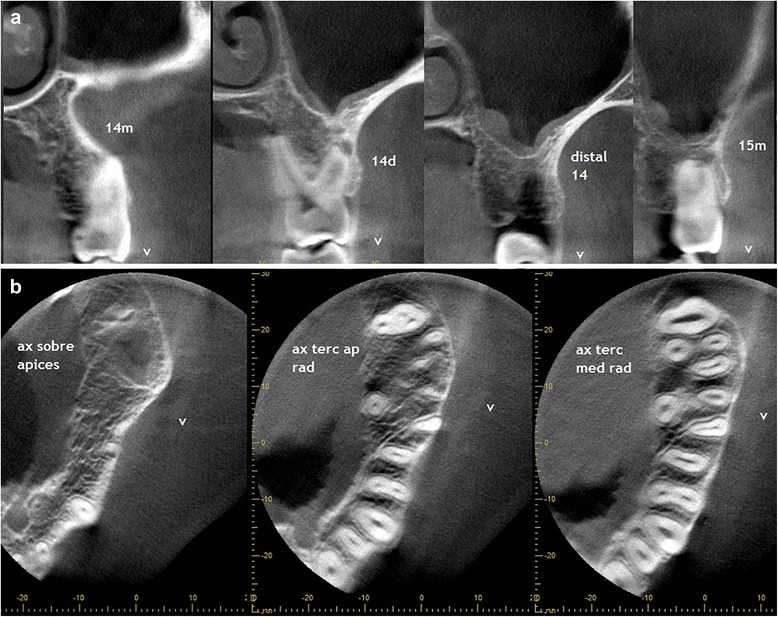 Fig. 10