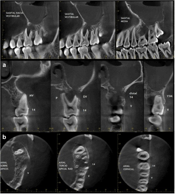 Fig. 4