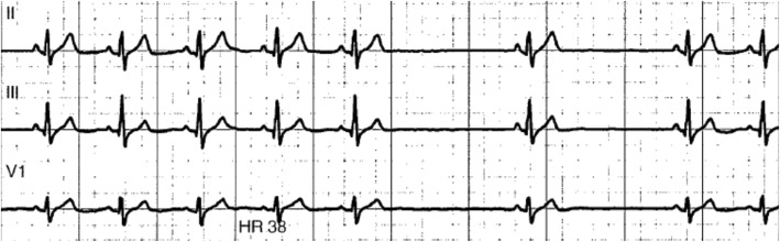 Fig. 2