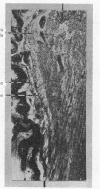 354