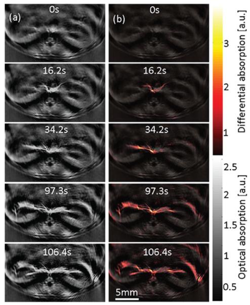 Figure 11