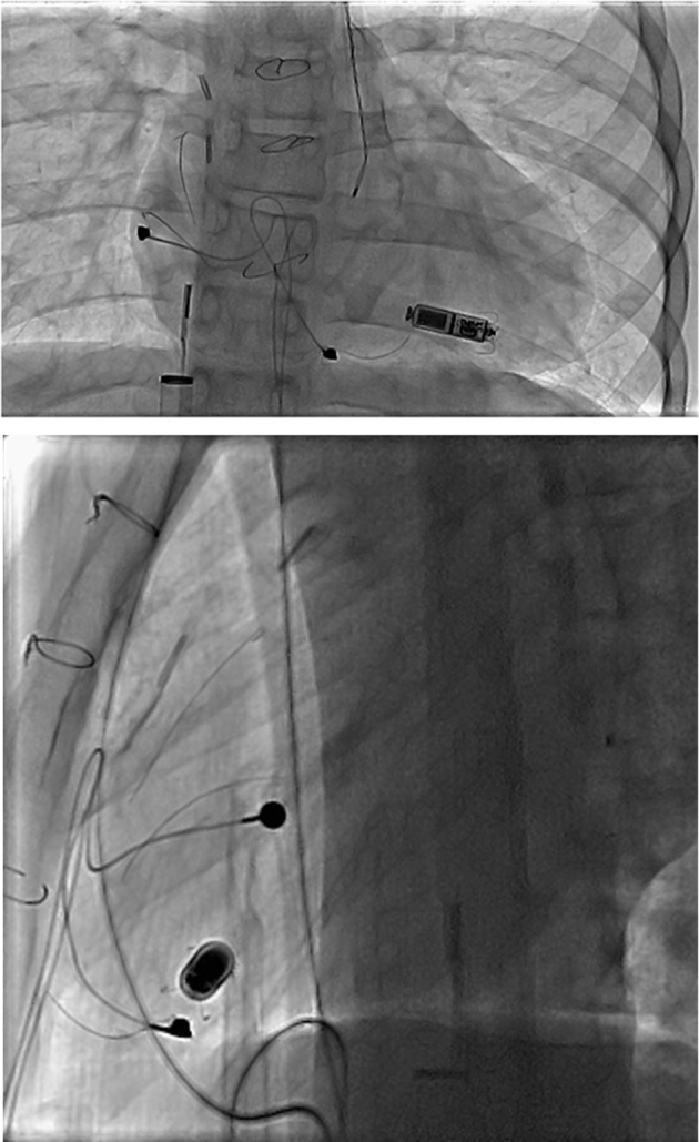 Figure 1