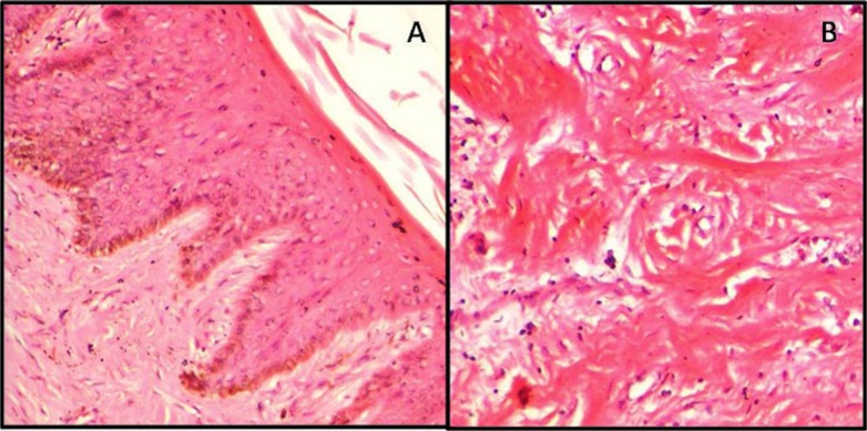 Fig.1