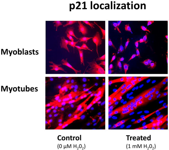 Dietary resveratrol confers apoptotic resistance to oxidative stress in ...