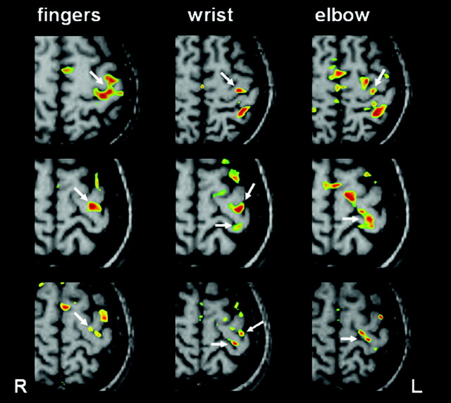 Fig 2.