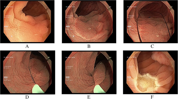 FIGURE 2