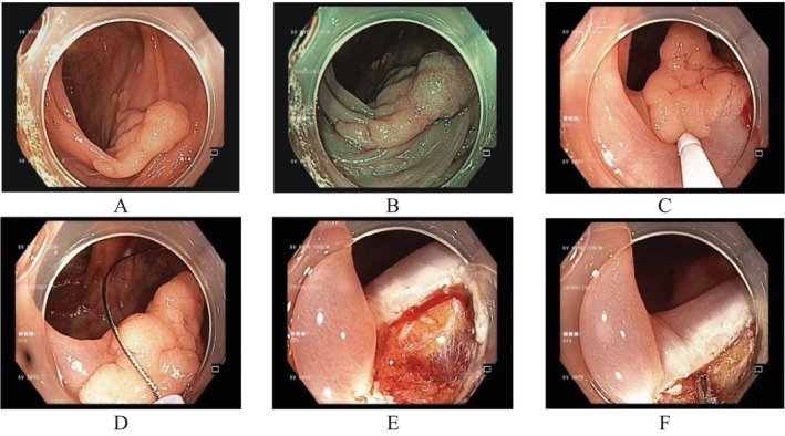 FIGURE 1