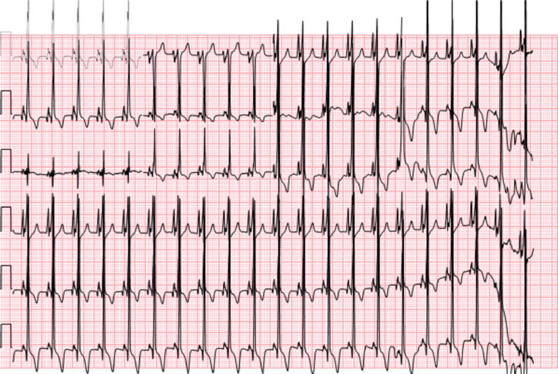 Fig. 2