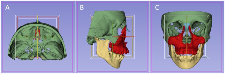 Fig 1