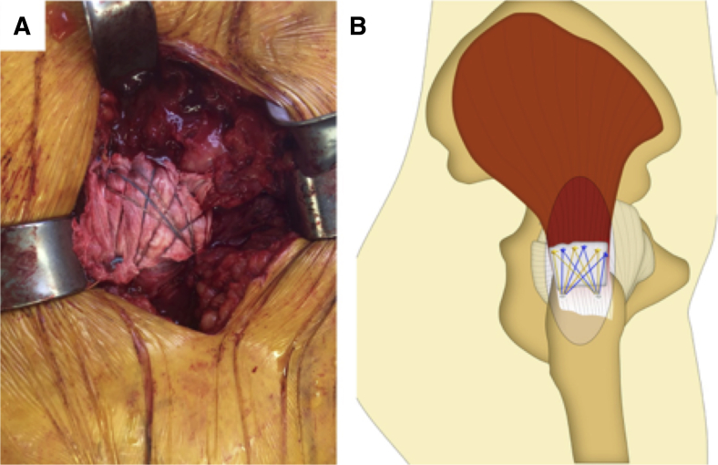 Fig 7