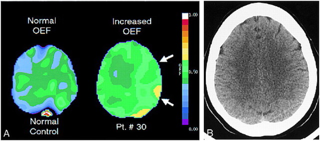 fig 4.