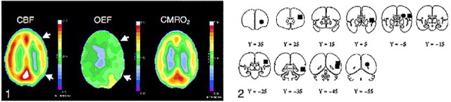 fig 1.