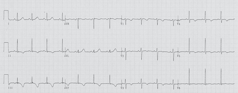 Fig. 2