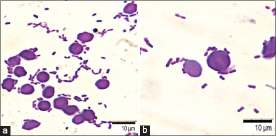 Figure-2