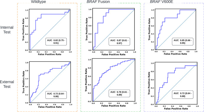 Graphs of receiver operating characteristic curves of the scan-to-prediction pipeline’s predictions for all three molecular subtype classes on internal testing (n = 59) and external testing (n = 112). The models, trained with TransferX, form the individual subtype classifiers. The outputs of the subtype classifiers are pooled using consensus logic, resulting in the pipeline predictions for each mutation class. AUC = area under the receiver operating characteristic curve.